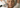 The GLP-1 Era: The New Weight-Loss Revolution and What It Means for Your Face