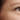Fine Lines vs Wrinkles: What’s the Difference and How Do You Treat Them
