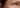Fine Lines vs Wrinkles: What’s the Difference and How Do You Treat Them