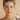Wrinkle Relaxers - Botox & Dysport